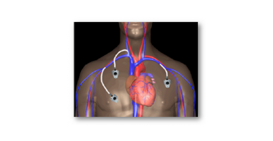 Camera implantabila Celsite - inovatie pentru cresterea calitatii vietii