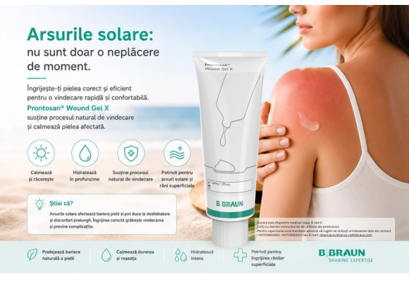 Arsuri solare la mare: ce faci când soarele a fost prea generos cu pielea